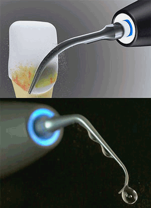 Acteon Newtron P5 XS B LED Ultrasonic Scaler with Intro Kit