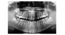 Gendex GXDP-700 Cephalometric and Panoramic X-ray