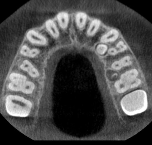 Carestream Kodak 9300c Select Panoramic, Cephalometric, Cone Beam