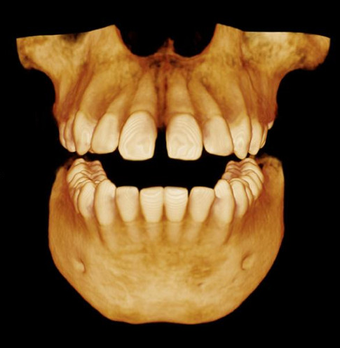 Carestream Kodak 9300c Select Panoramic, Cephalometric, Cone Beam
