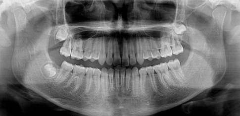 Carestream Kodak 9300c Select Panoramic, Cephalometric, Cone Beam