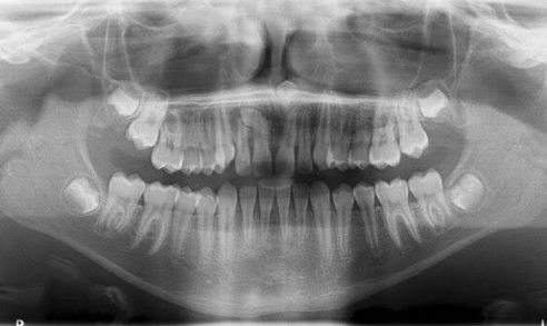 Carestream Kodak 9300c Select Panoramic, Cephalometric, Cone Beam