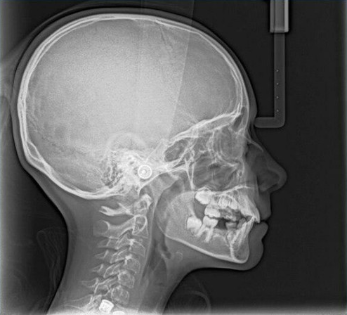 Carestream Kodak 9300c Select Panoramic, Cephalometric, Cone Beam