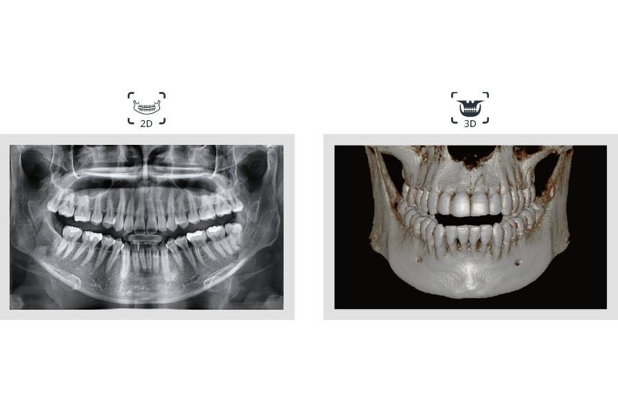 Vatech Smart Plus CBCT Dental X-ray with Ceph