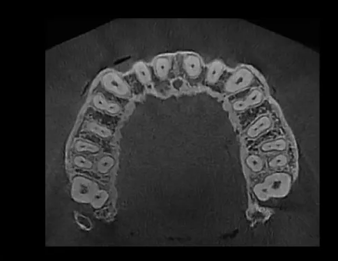 Eco-X CBCT X-ray from HDX Will (16x9)