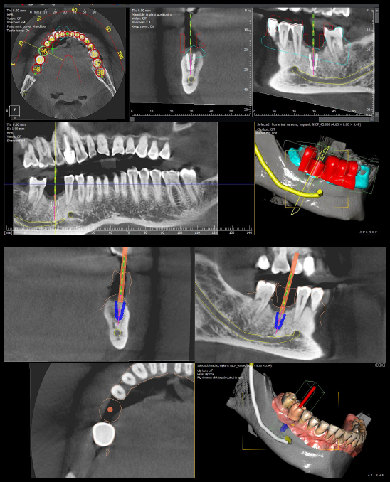 I-Max Ceph PRO Dental X-ray by Owandy