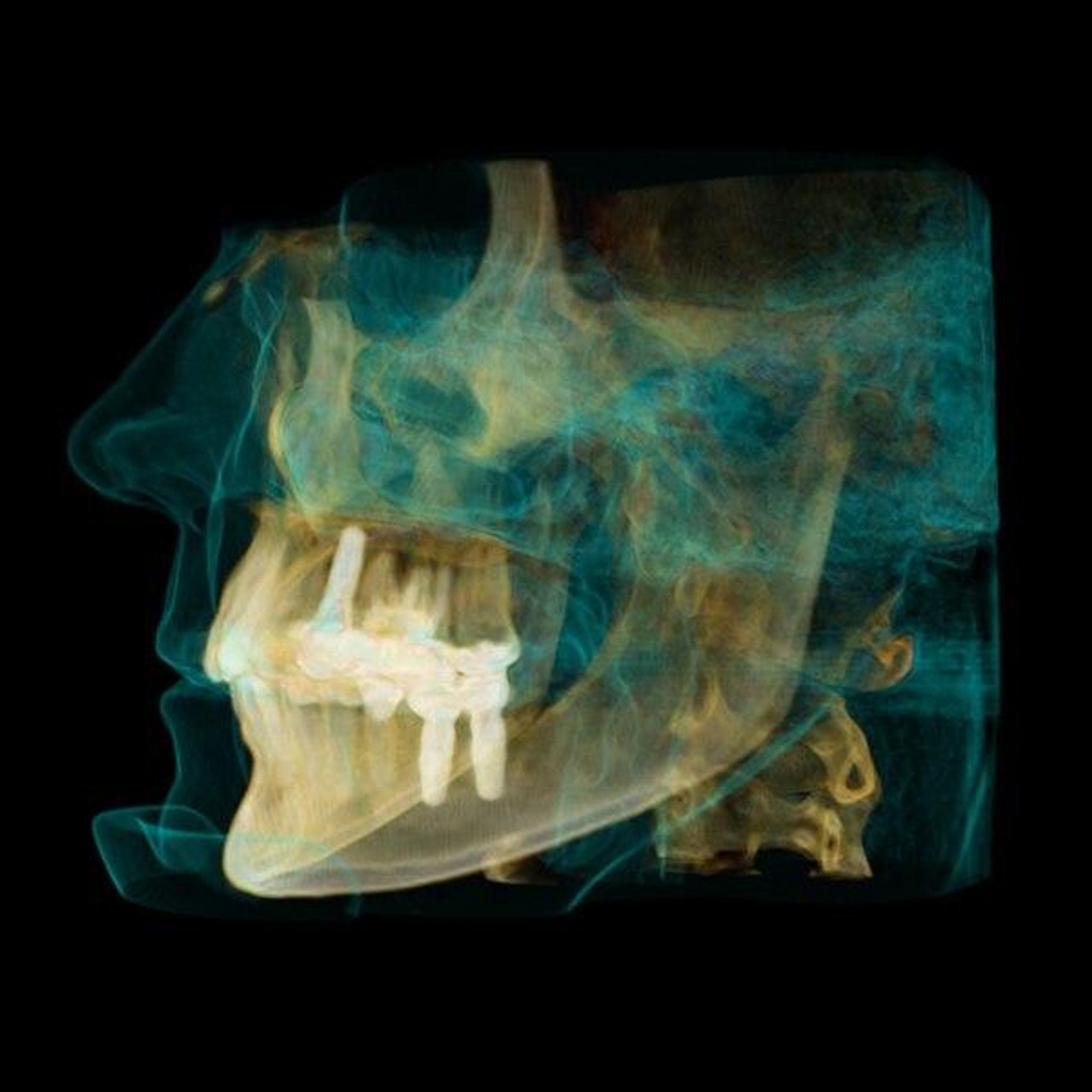 Carestream Kodak 9300c Premium Panoramic, Cephalometric, Cone Beam