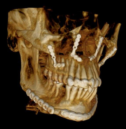 Carestream Kodak 9300c Premium Panoramic, Cephalometric, Cone Beam