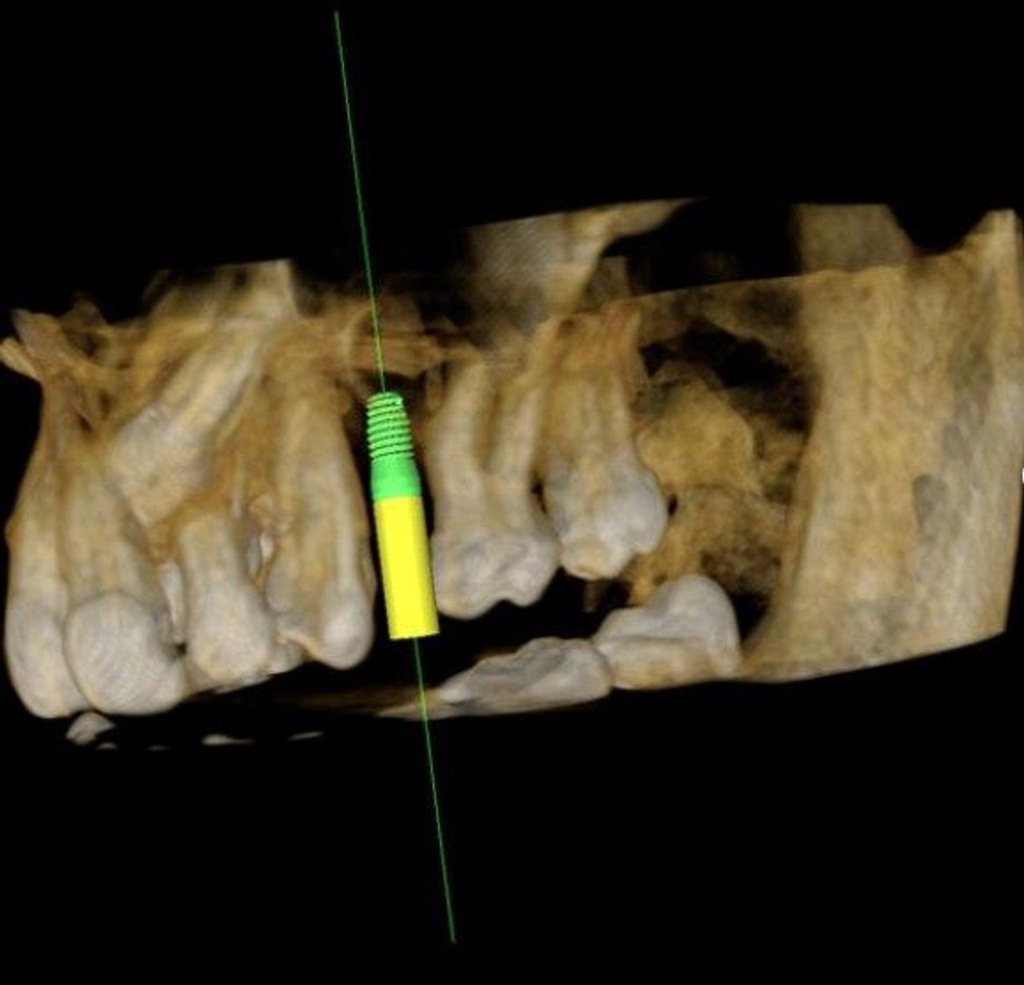 Carestream Kodak 9300c Premium Panoramic, Cephalometric, Cone Beam