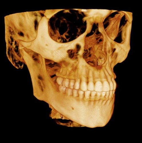 Carestream Kodak 9300c Premium Panoramic, Cephalometric, Cone Beam