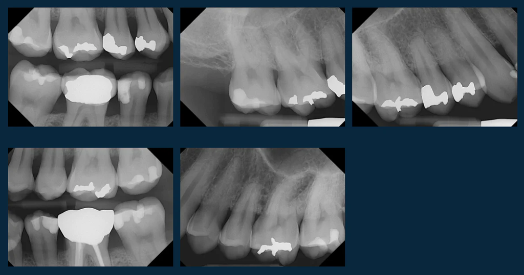 Dentimax Open Sensor