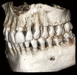 Gendex GXDP-700 Panoramic, Ceph plus CBCT