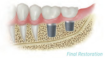 Gendex GXDP-700 Panoramic, Ceph plus CBCT