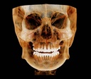 Dentri Max CBCT (16x18) - HDX Will
