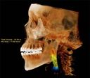 Dentri Max CBCT (16x18) - HDX Will
