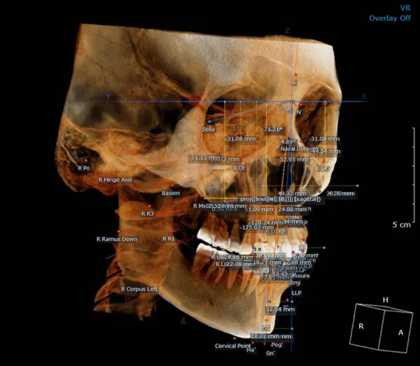 Dentri Max CBCT (16x18) - HDX Will