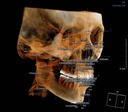 Dentri Max CBCT (16x18) - HDX Will