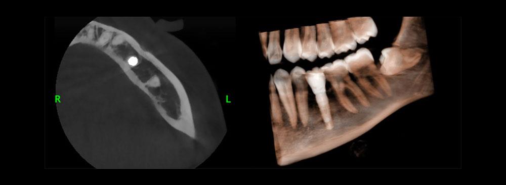 Explorer EX (2 in 1)