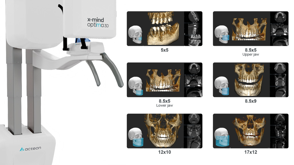Acteon X-Mind Optima 3D Cone Beam + Panoramic X-ray (12x10 FOV)