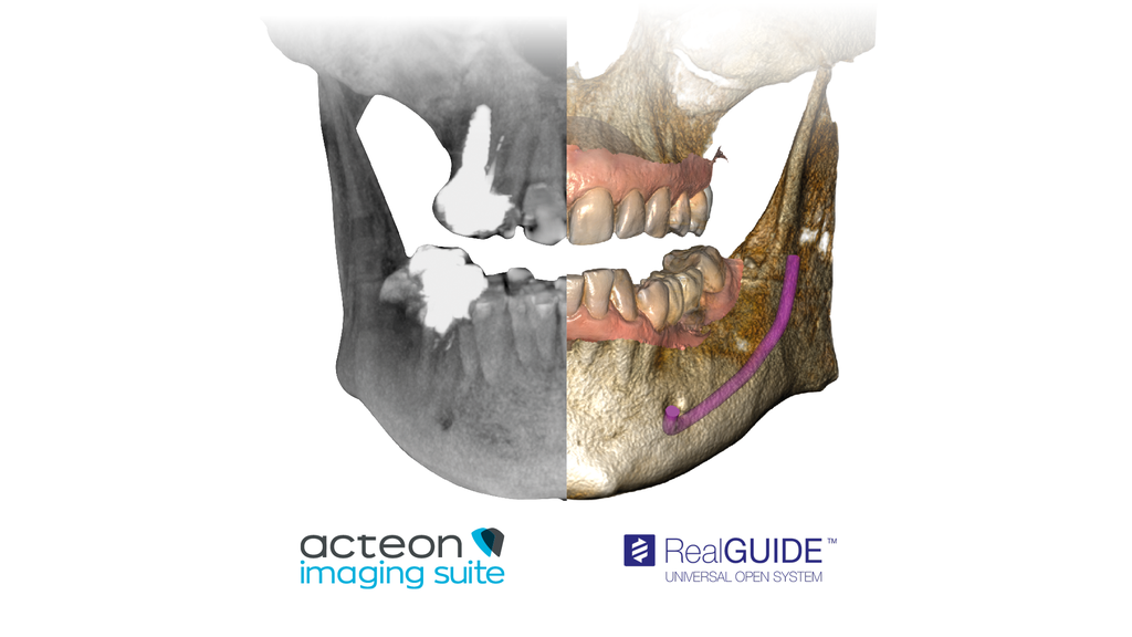 Acteon X-Mind Optima 3D Cone Beam + Panoramic X-ray (12x10 FOV)