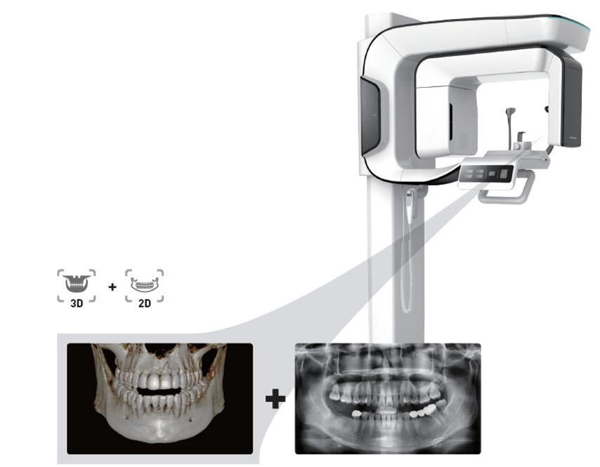 Vatech PaX-i3D Smart Cone Beam & Panoramic Xray