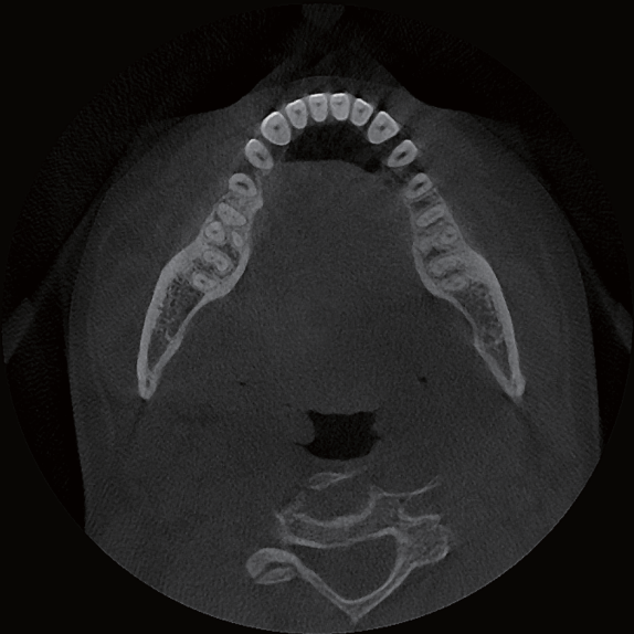 RAYSCAN Alpha Plus 130 3-in-1 CBCT