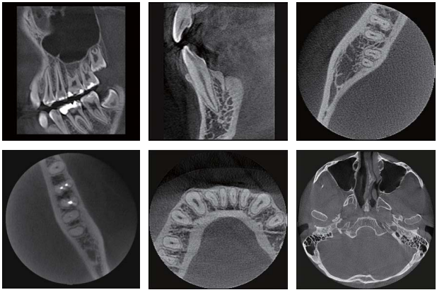 RAYSCAN Alpha Plus 130 3-in-1 CBCT