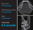 RAYSCAN Alpha Plus 130 3-in-1 CBCT