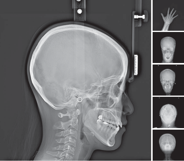 RAYSCAN Alpha Plus 130 3-in-1 CBCT