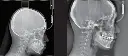 Ray America Rayscan Studio 3D CBCT