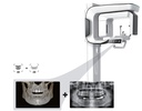 Vatech PaX-i3D Smart Cone Beam & Panoramic Xray