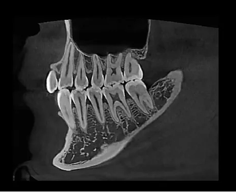 Eco-X CBCT X-ray from HDX Will (16x9)