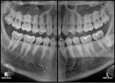Eco-X CBCT X-ray from HDX Will (16x9)