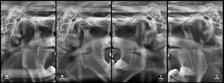 Eco-X CBCT X-ray from HDX Will (16x9)