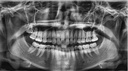 Vatech PaX-i Green CT Panoramic + Cone Beam - 15x15 fov