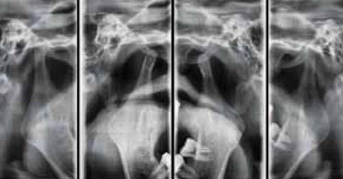 Vatech PaX-i Green CT Panoramic + Cone Beam - 15x15 fov