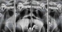 Vatech PaX-i Green CT Panoramic + Cone Beam - 15x15 fov