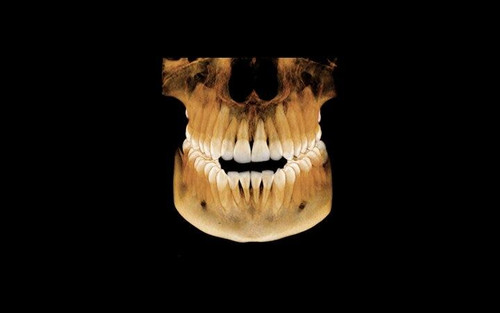 Vatech PaX-i Green CT Panoramic + Cone Beam - 15x15 fov
