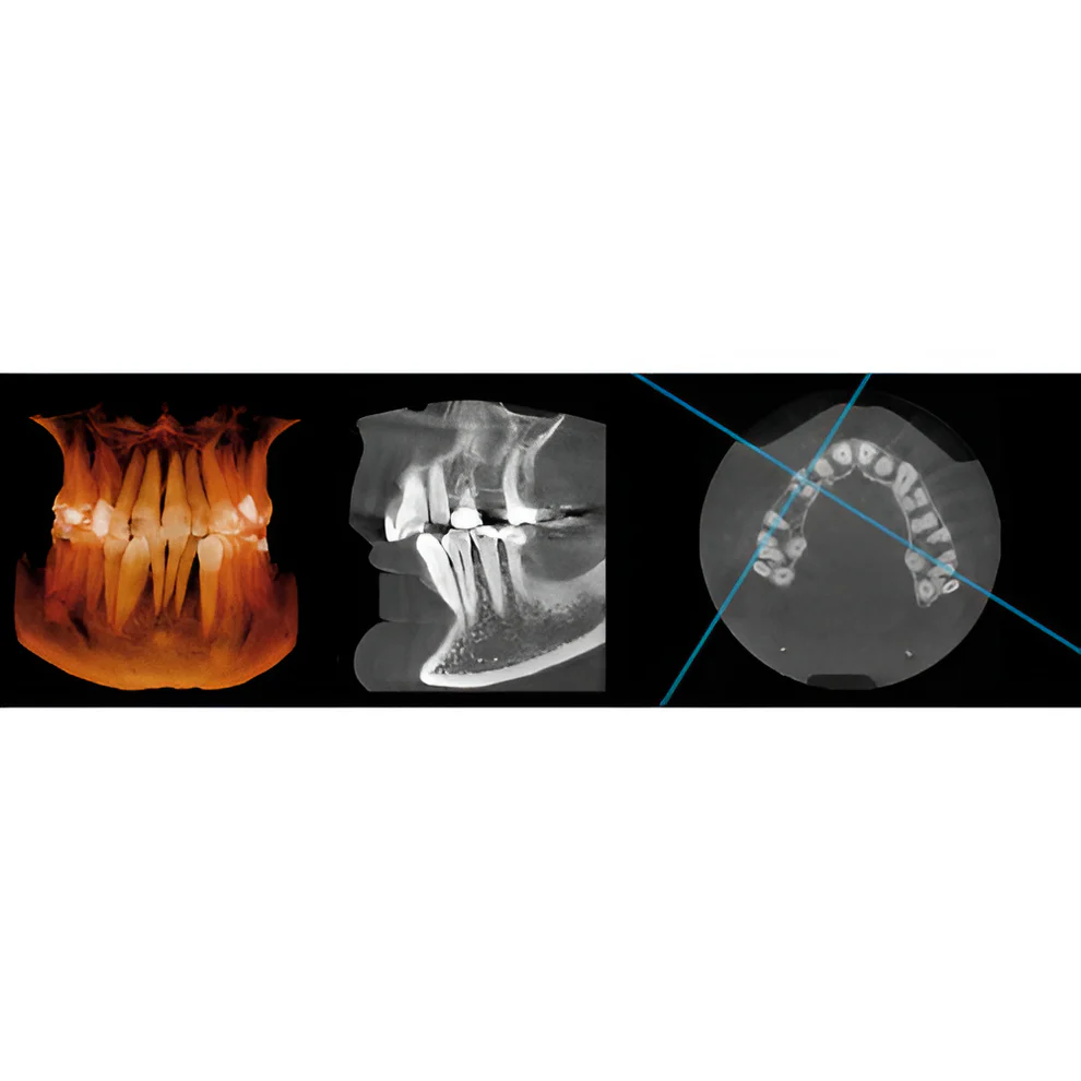 Instrumentarium OP300 Maxio Pan + CBCT - 8x15 FOV