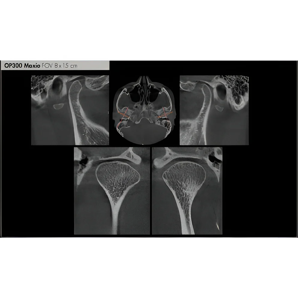 Instrumentarium OP300 Maxio Pan + CBCT - 8x15 FOV