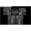 Instrumentarium OP300 Maxio Pan + CBCT - 8x15 FOV