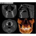 Instrumentarium OP300 Maxio Pan + CBCT - 8x15 FOV
