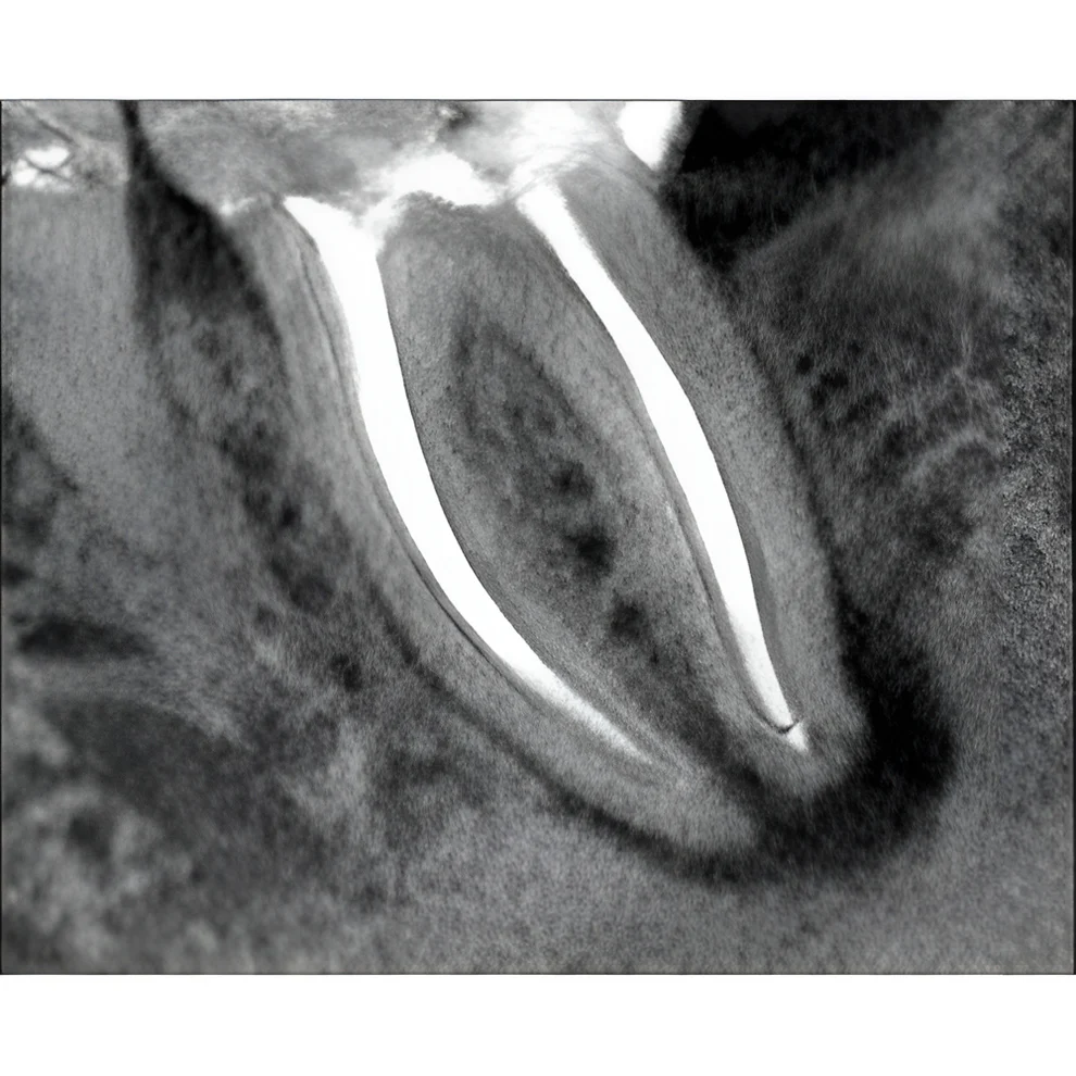 Instrumentarium OP300 Maxio Pan + CBCT - 8x15 FOV