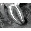 Instrumentarium OP300 Maxio Pan + CBCT - 8x15 FOV