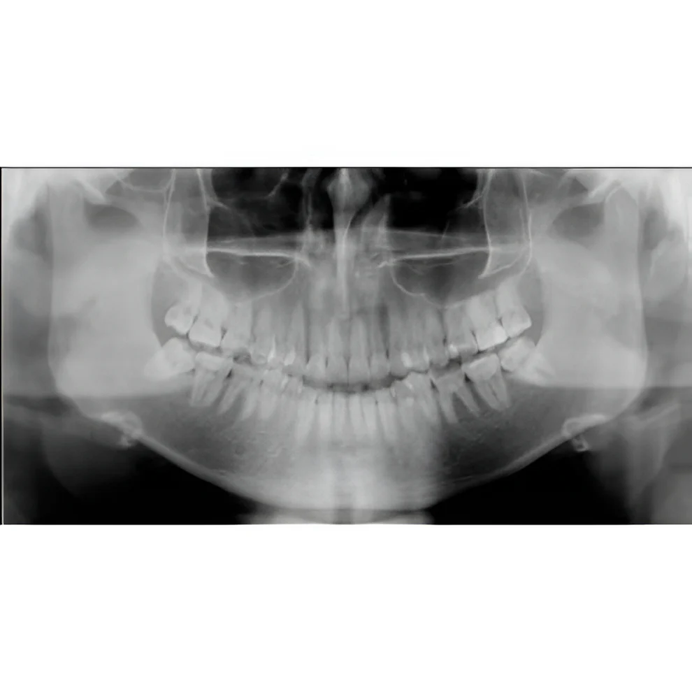 Instrumentarium OP300 Maxio Pan + CBCT - 8x15 FOV