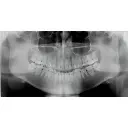 Instrumentarium OP300 Maxio Pan + CBCT - 8x15 FOV