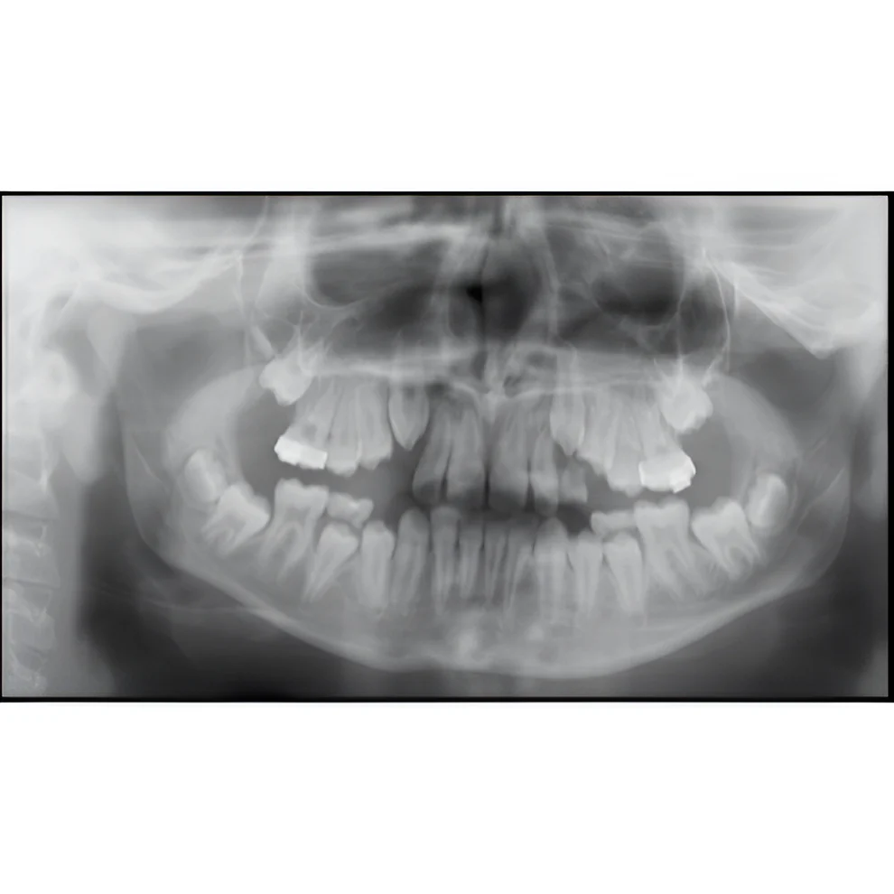 Instrumentarium OP300 Maxio Pan + CBCT - 8x15 FOV