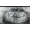 Instrumentarium OP300 Maxio Pan + CBCT - 8x15 FOV