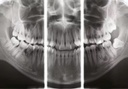 Dexis Op 3d Panoramic + Cone Beam