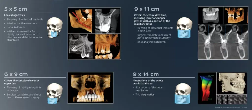 Dexis Op 3d Panoramic + Cone Beam